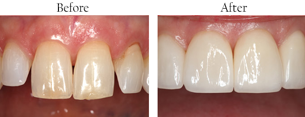 dental images 07417